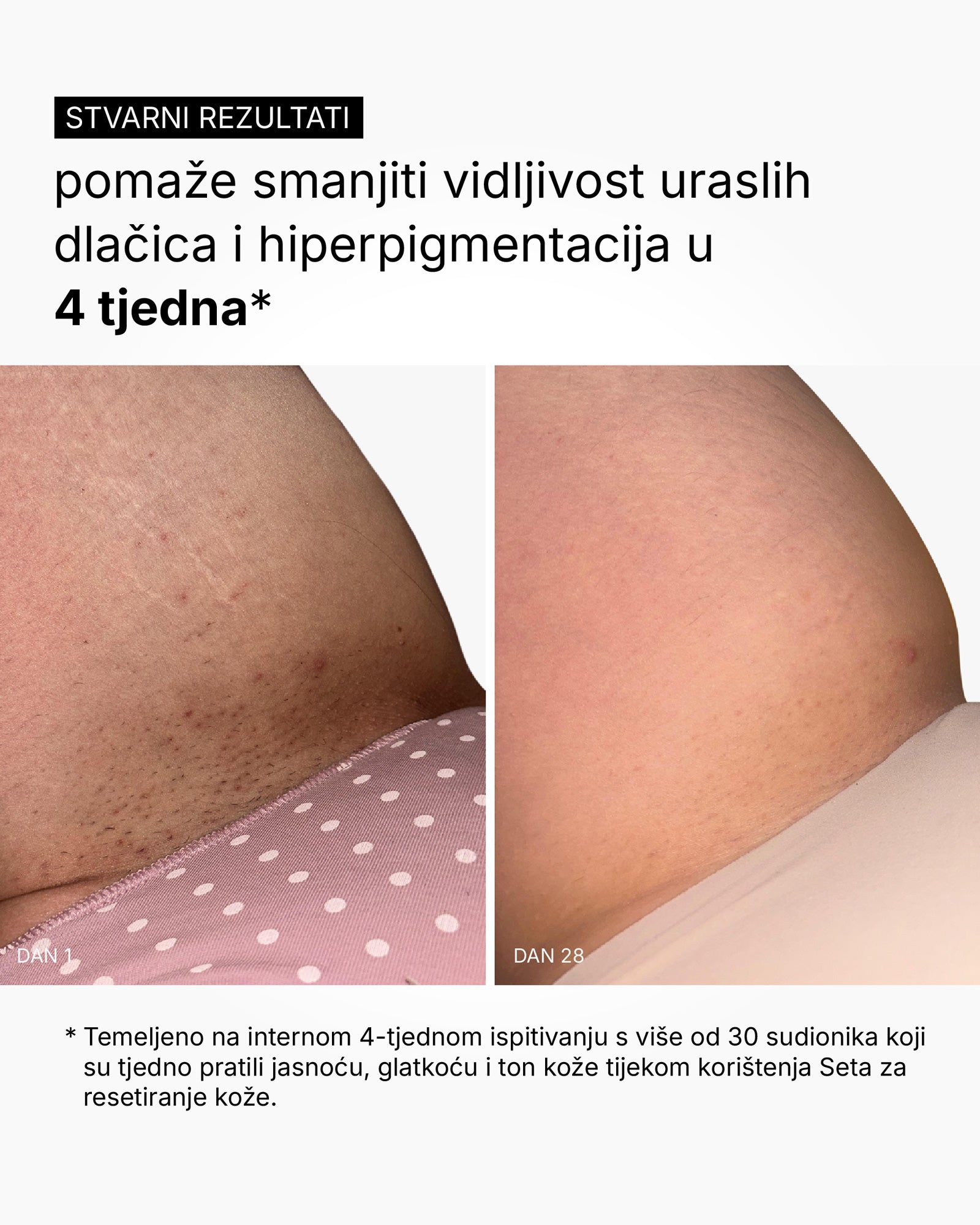 Skin Reset Set - Full Body Routine